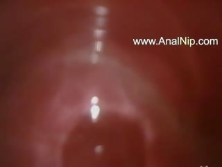 Dolce jap anale pelosa adulti clip